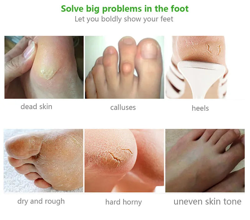 Exfoliating Foot Mask Foot SPA Pedicure Socks Exfoliation Scrub Remove Dead Skin Pedicure Socks Whitening Foot Foot Skin Care