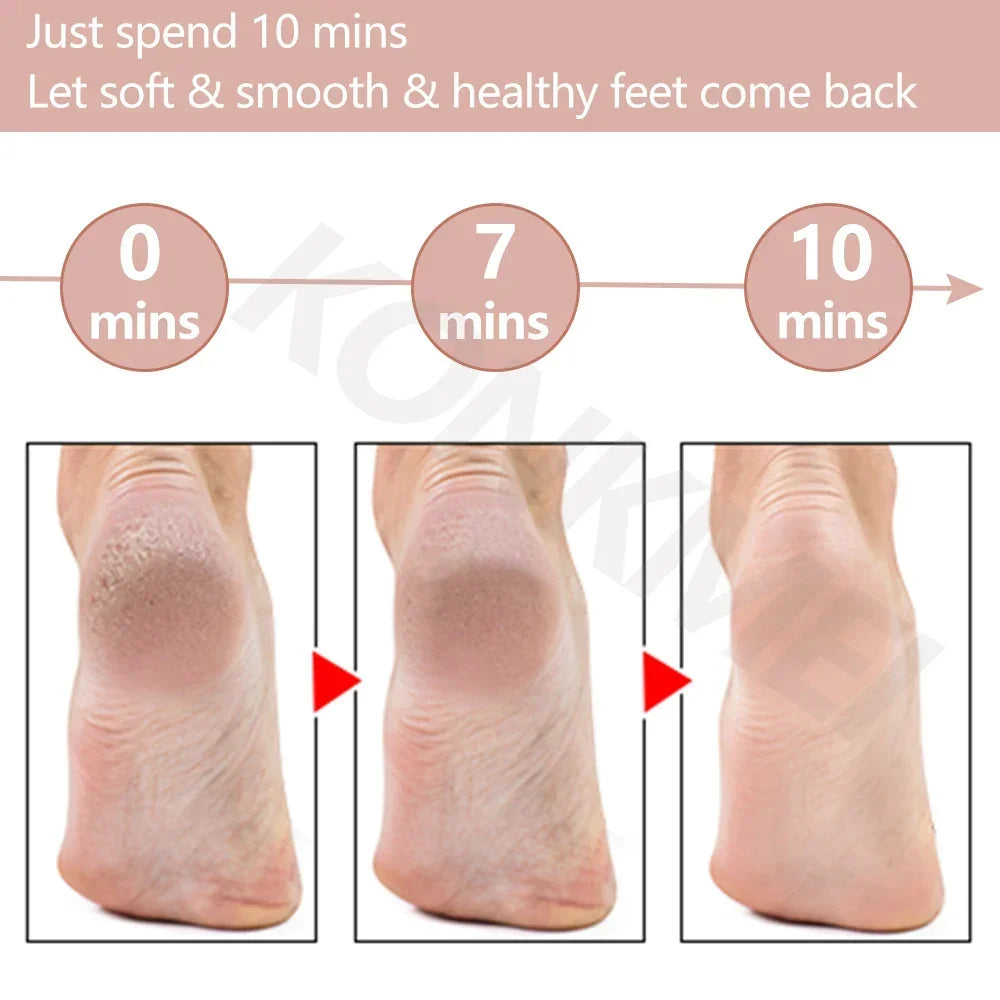 Rechargeable Electric Foot Callus Remover Pedicure Machine Foot Grinder Foot Tools Foot Files Clean Tools for Hard Cracked Skin