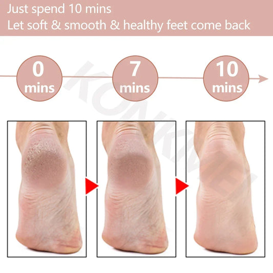 Rechargeable Electric Foot Callus Remover Pedicure Machine Foot Grinder Foot Tools Foot Files Clean Tools for Hard Cracked Skin