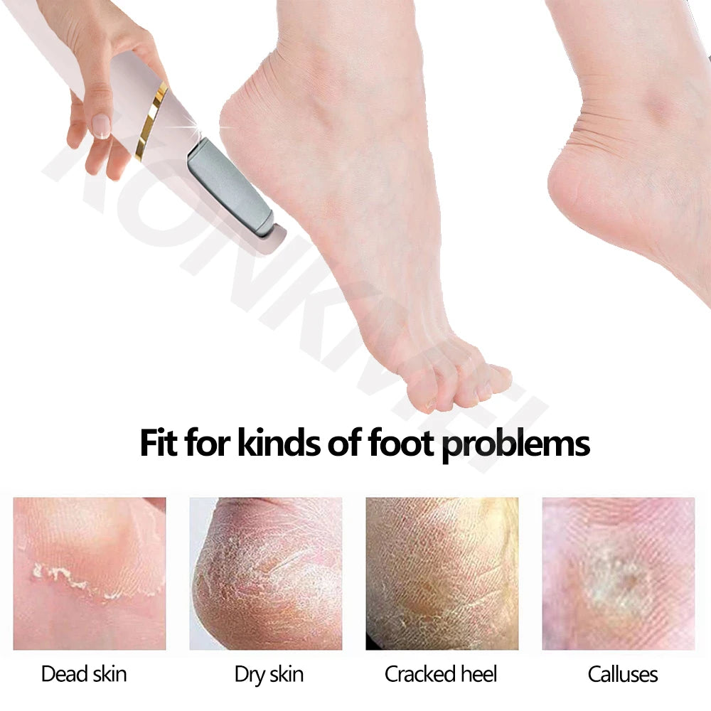 Rechargeable Electric Foot Callus Remover Pedicure Machine Foot Grinder Foot Tools Foot Files Clean Tools for Hard Cracked Skin