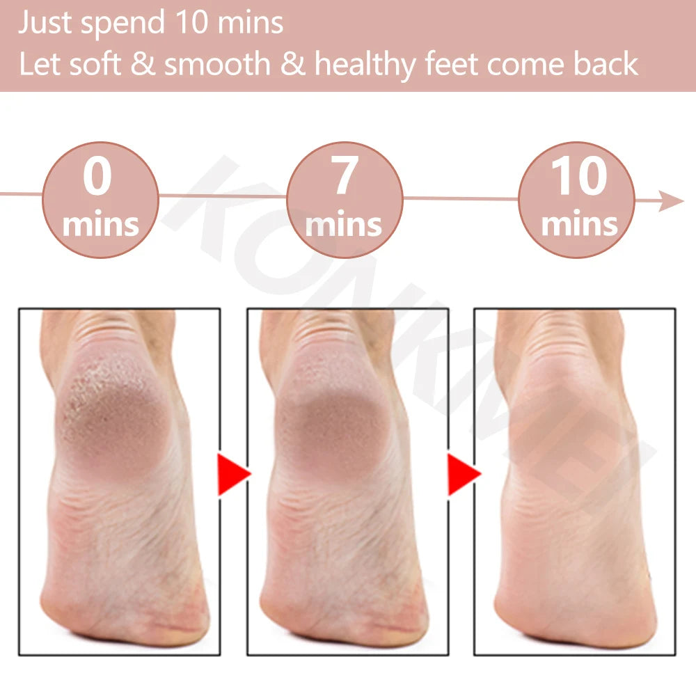 Rechargeable Electric Foot Callus Remover Pedicure Machine Foot Grinder Foot Tools Foot Files Clean Tools for Hard Cracked Skin